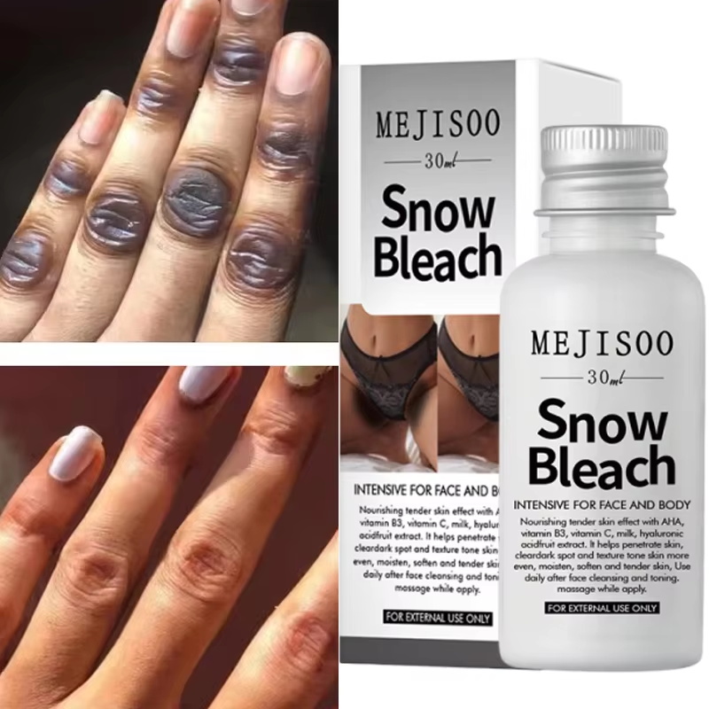 Korean Lifestyle Products - Fast Whitening Dark Knuckles Brighten Hand