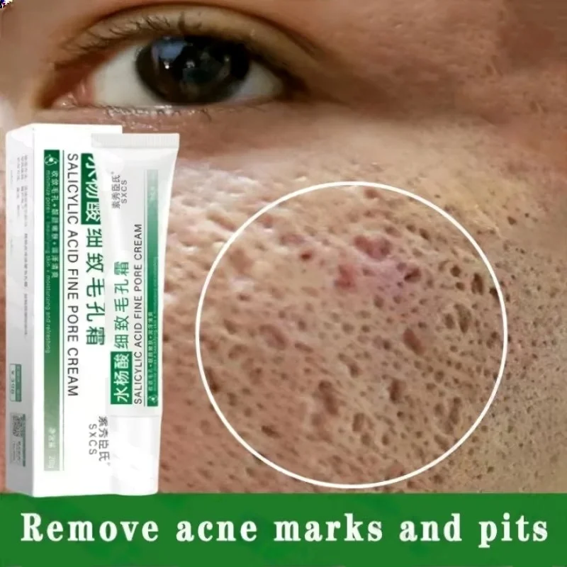 Korean Lifestyle Products - Salicylic Acid Pore Clearing Cream Shrink