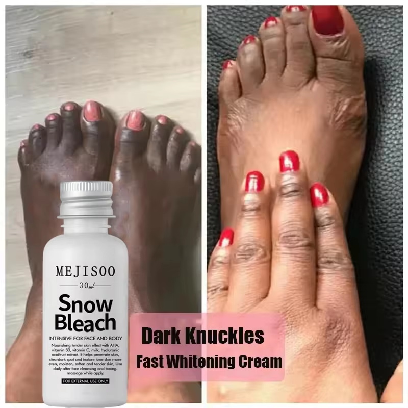 Fast Whitening Dark Knuckles B - огляд і ціна Korean Lifestyle Products