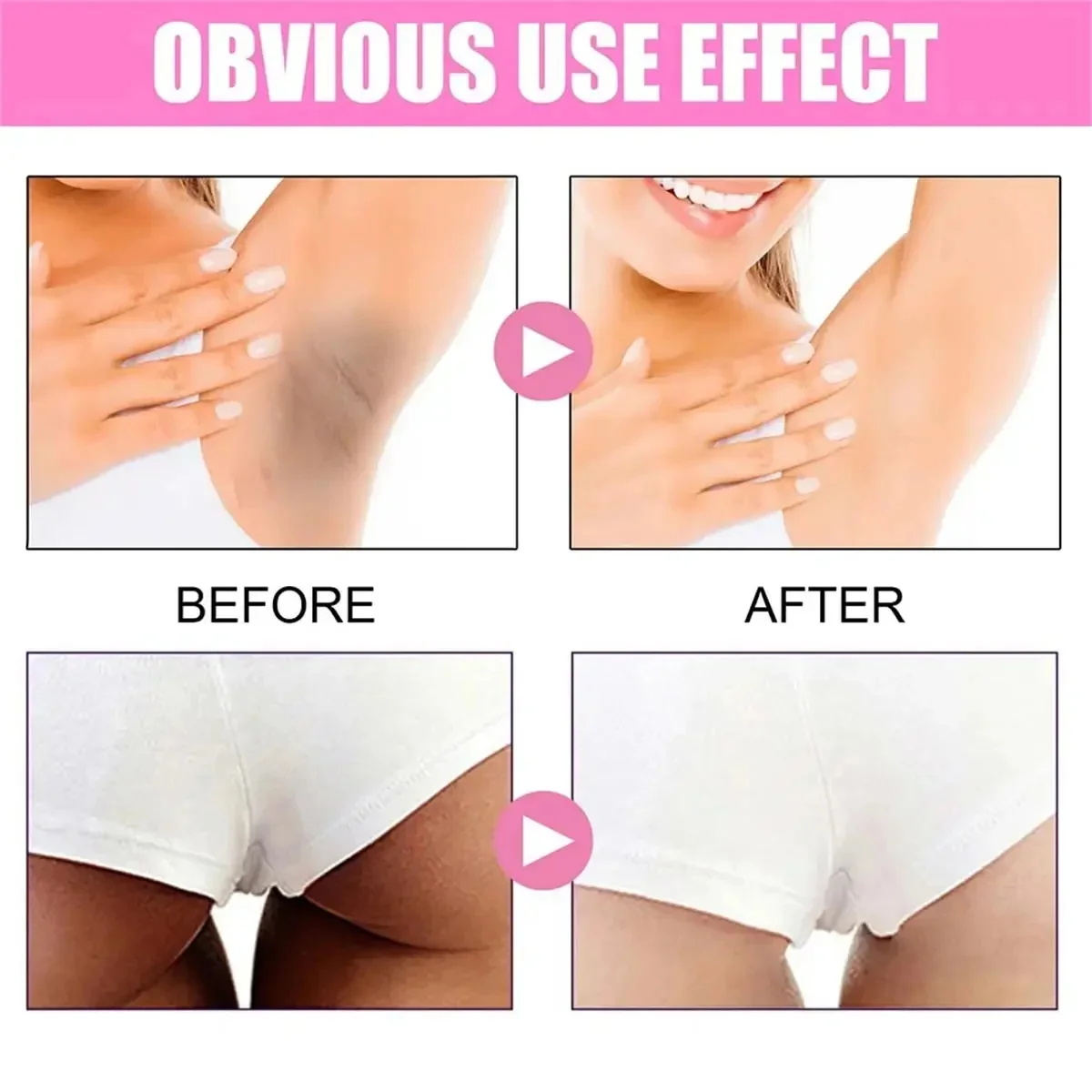 Fast Whitening Dark Knuckles B - огляд і ціна Korean Lifestyle Products