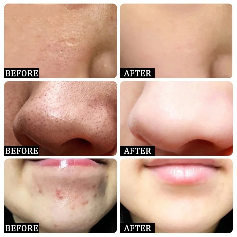 Salicylic Acid Pore Clearing C - огляд і ціна Korean Lifestyle Products