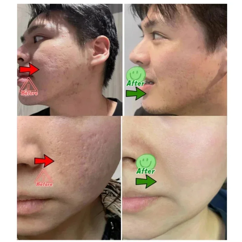 Salicylic Acid Pore Clearing C - огляд і ціна Korean Lifestyle Products
