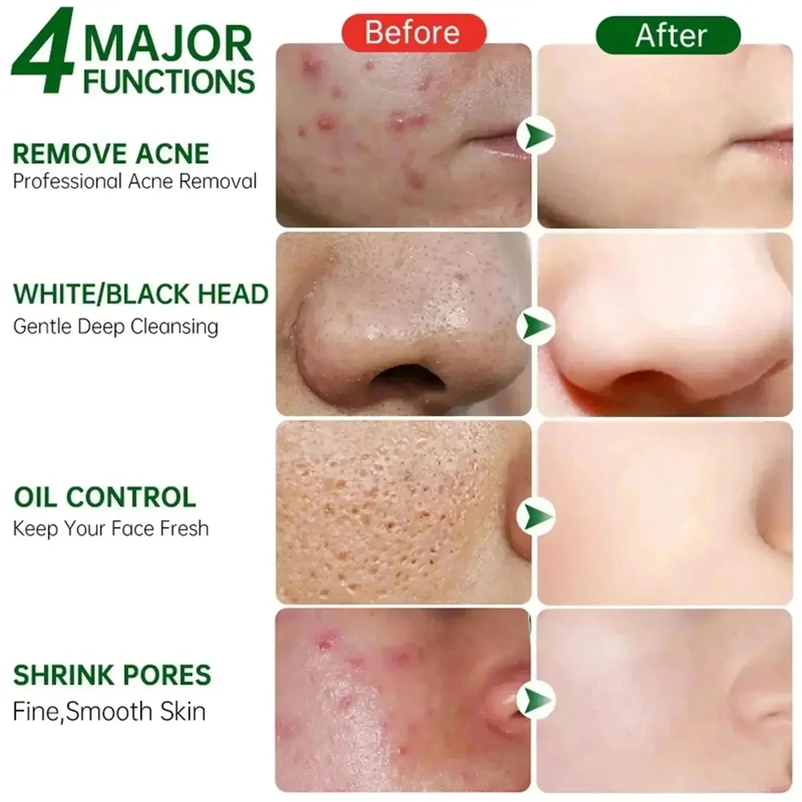 Salicylic Acid Pore Clearing C - огляд і ціна Korean Lifestyle Products
