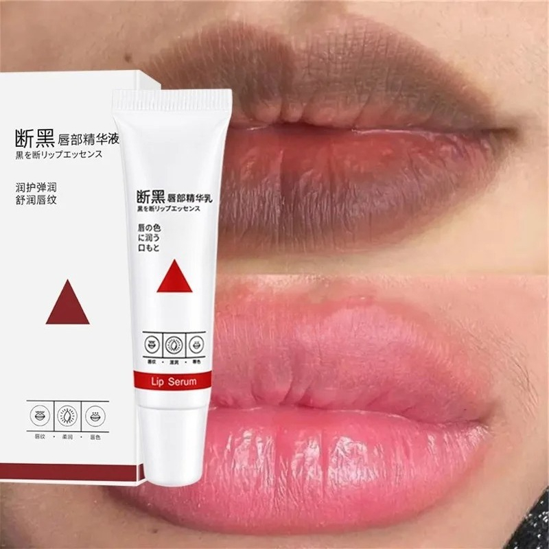 Remove Dark Lip Balm Fast Ligh - огляд і ціна Korean Lifestyle Products