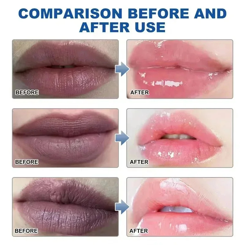 Remove Dark Lip Balm Fast Ligh - огляд і ціна Korean Lifestyle Products
