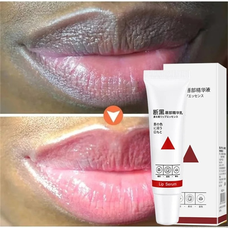 Remove Dark Lip Balm Fast Ligh - огляд і ціна Korean Lifestyle Products
