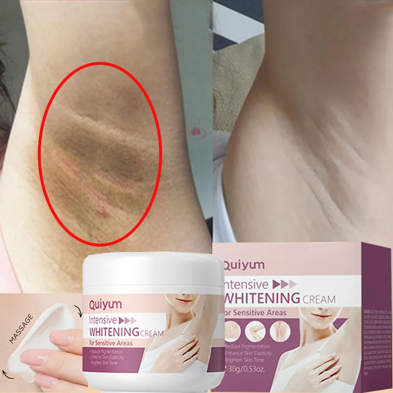 Whitening Cream For Dark Skin  - огляд і ціна Korean Lifestyle Products