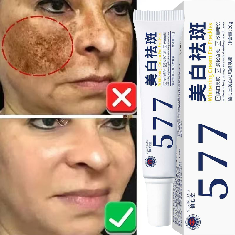 Whitening Freckle Cream Melasm - огляд і ціна Korean Lifestyle Products