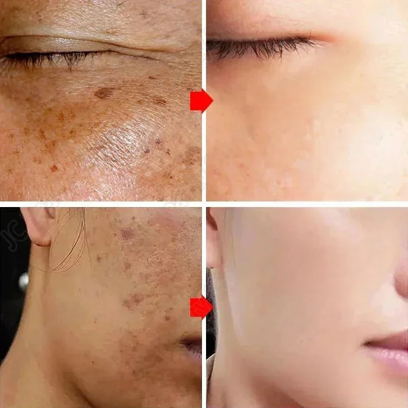 Whitening Freckle Cream Melasm - огляд і ціна Korean Lifestyle Products
