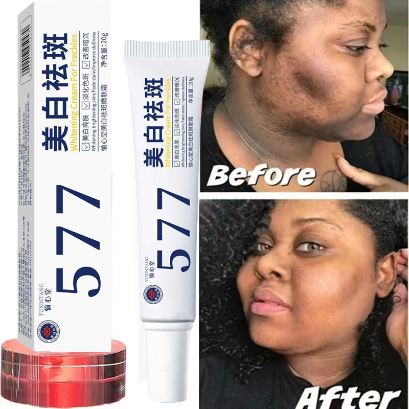 Whitening Freckle Cream Melasm - огляд і ціна Korean Lifestyle Products
