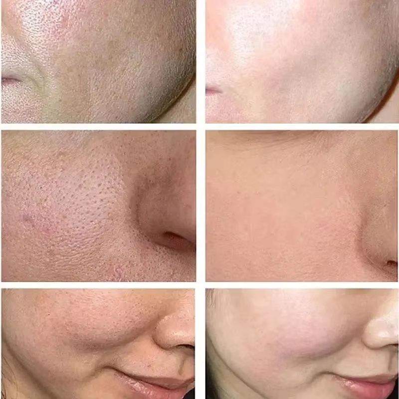 Salicylic Acid Pore Shrinking  - огляд і ціна Korean Lifestyle Products