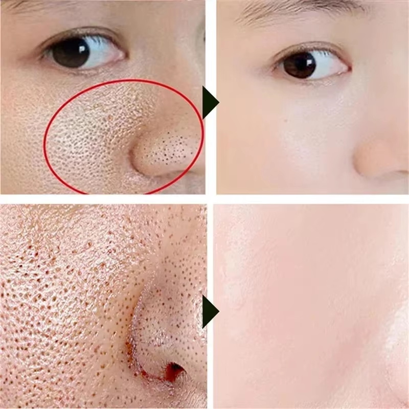 Salicylic Acid Pore Shrinking  - огляд і ціна Korean Lifestyle Products